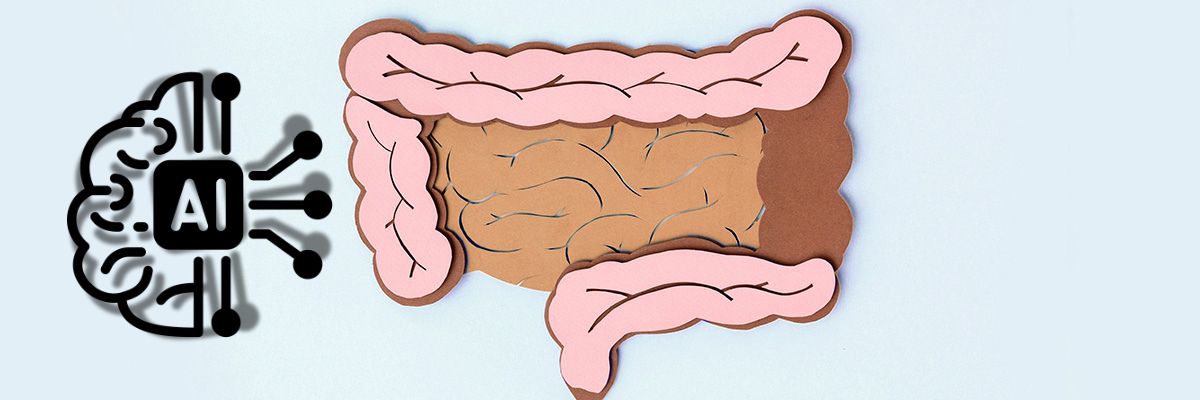 KI Darmspiegelung